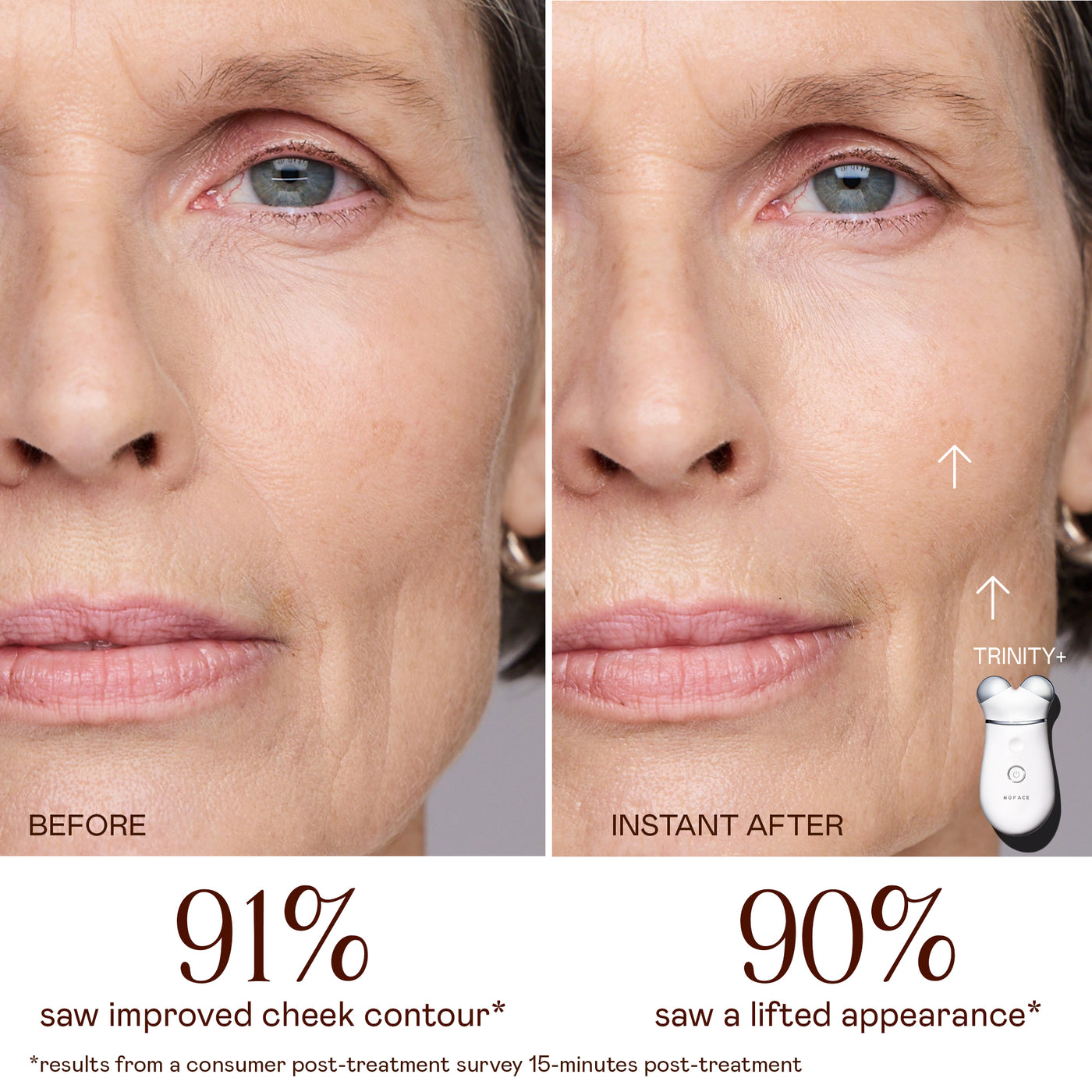 Real NUFACE user results, before and after